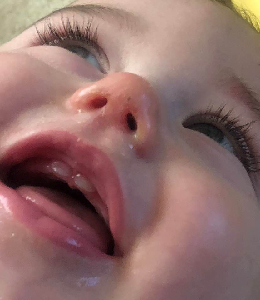 First Tooth
